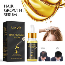 Load image into Gallery viewer, LAVDIK Ginger Fast Hair Growth Serum Essential Oil Anti Preventing Hair Lose Liquid Damaged Hair Repair Growing Dropship TSLM1
